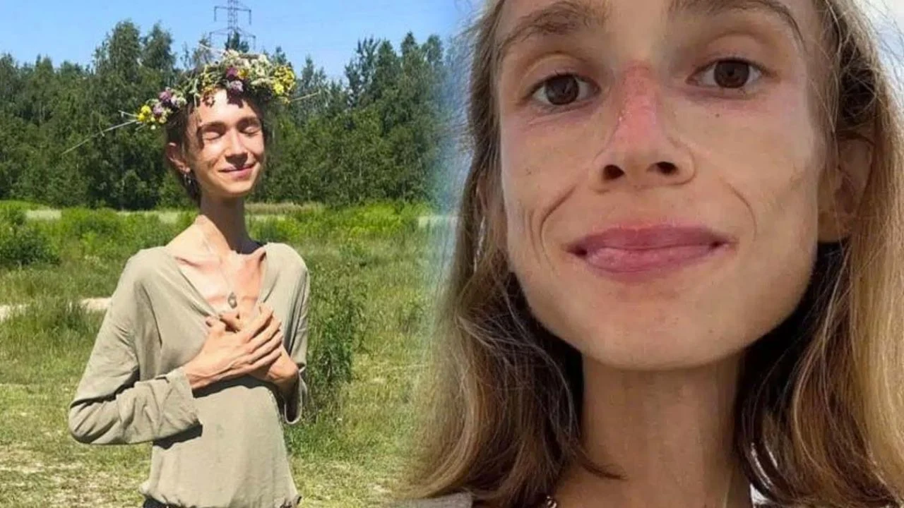 Muere joven vegana de 27 años que solo se alimentaba de frutas y pesaba 22 kilos