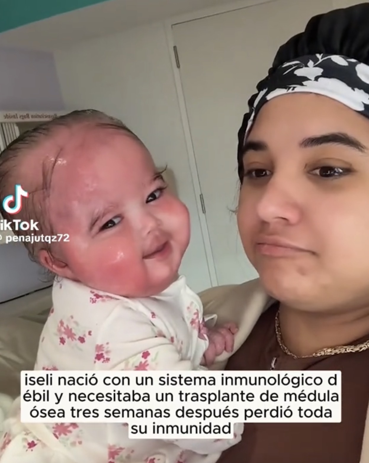 Bebé nace con un sistema inmunológico débil y conmueve a miles en redes tras perder su inmunidad semanas después