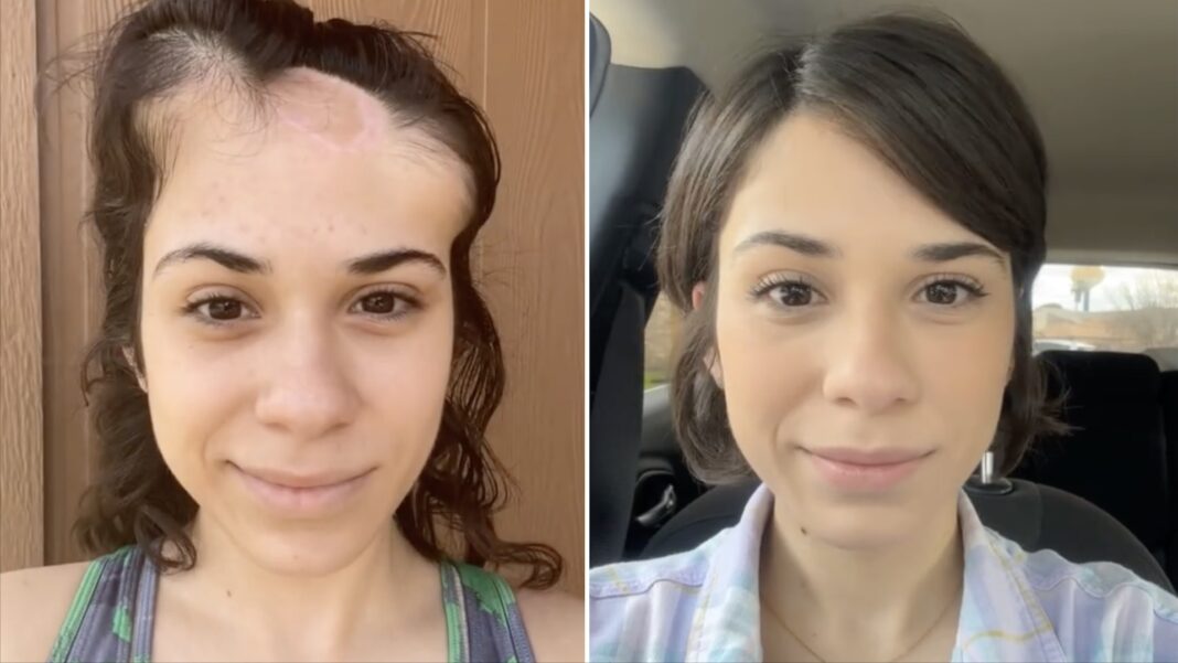 Joven con cáncer documenta su recuperación y sorprende con el resultado Joven con cáncer documenta su recuperación y sorprende con el resultado