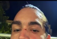 Miren lo que le hicieron a Giussepe ahora mismo: brutal agresión contra influencer en plena cancha