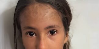 Angélica, una niña de 8 años en Portuguesa, necesita ayuda urgente para recibir atención médica