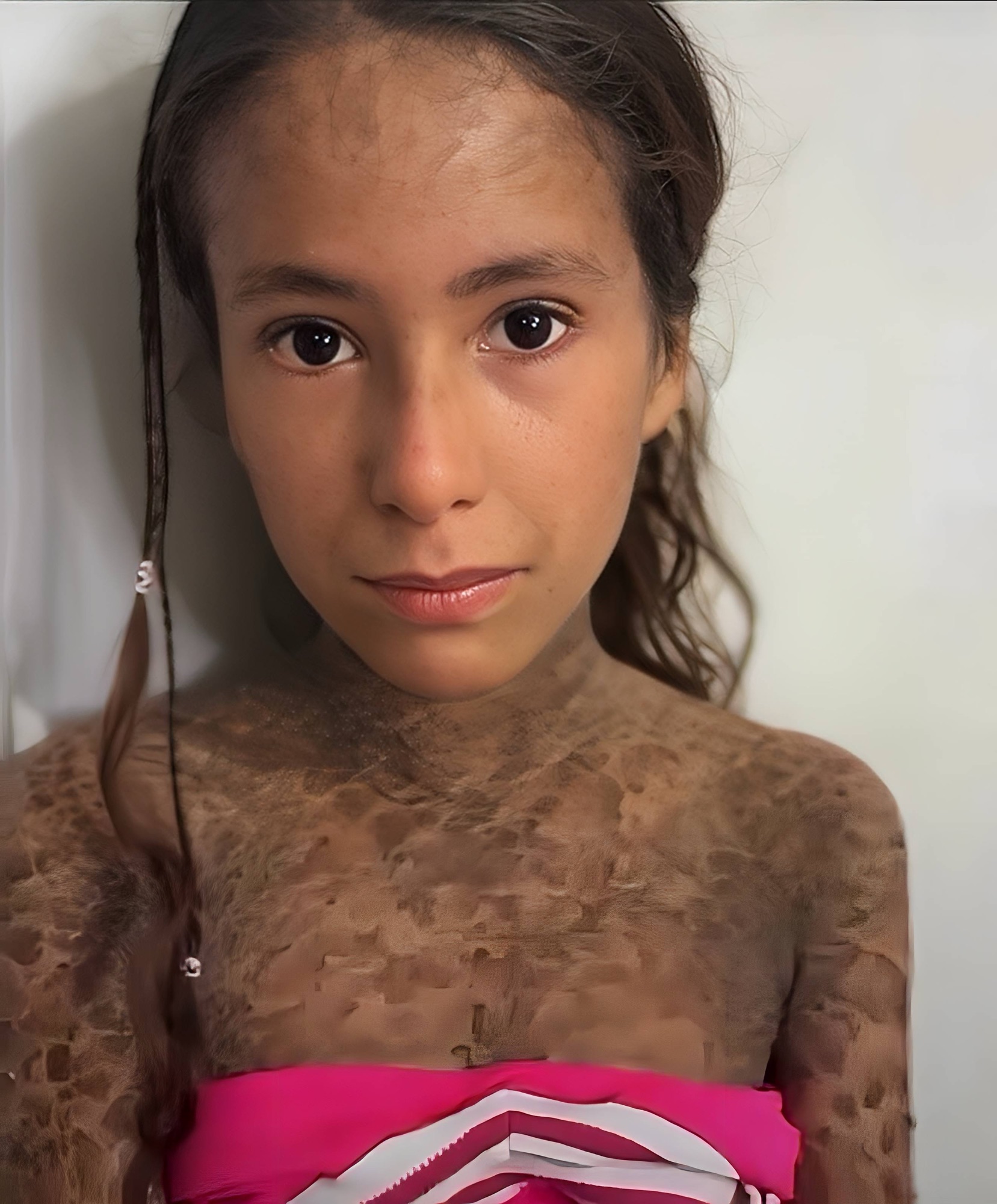 Angélica, una niña de 8 años en Portuguesa, necesita ayuda urgente para recibir atención médica 1 img 4670