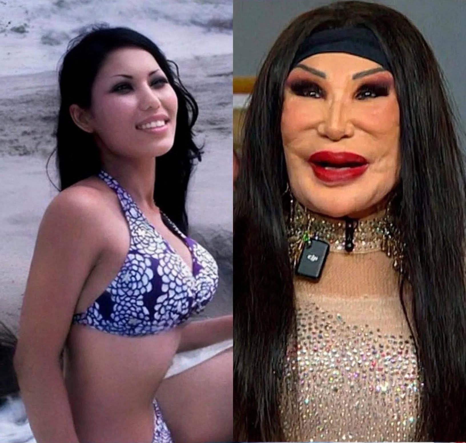 EL PRECIO DE LA VANIDAD: El antes y después de Lyn May, la vedette que fue engañada con aceite de cocina en el rostro